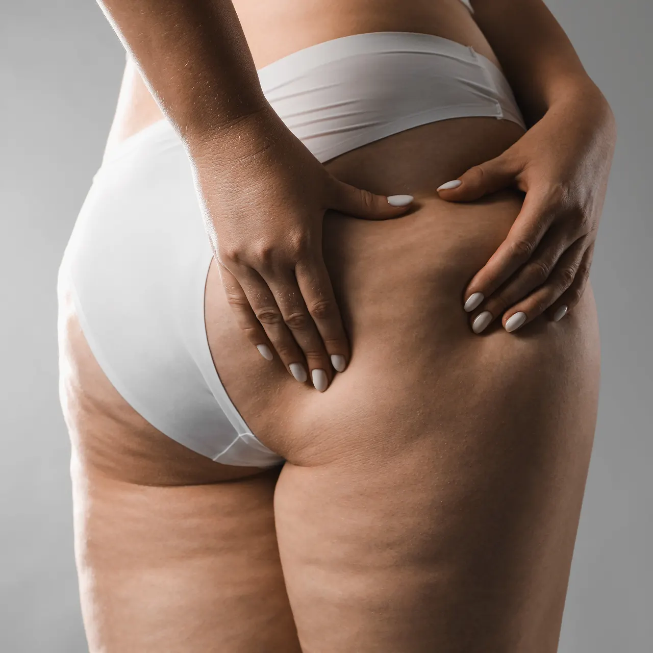 Linfedema e Lipedema em Erechim