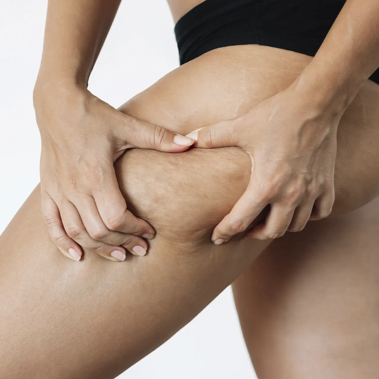 Linfedema e Lipedema em Erechim